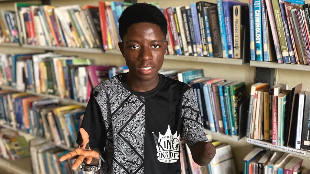 Nigeria: accusato di stregoneria, ragazzo perde una mano dopo torture